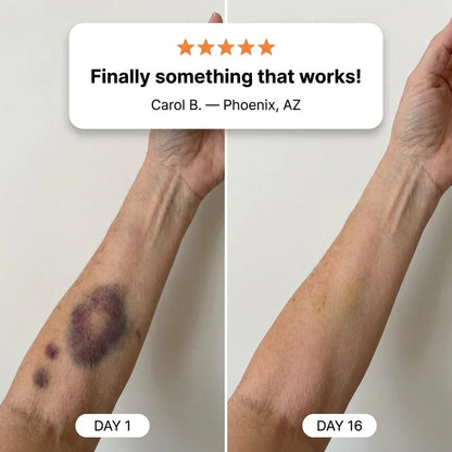 Bruise Appearance Care & Skin-Strengthening Cream